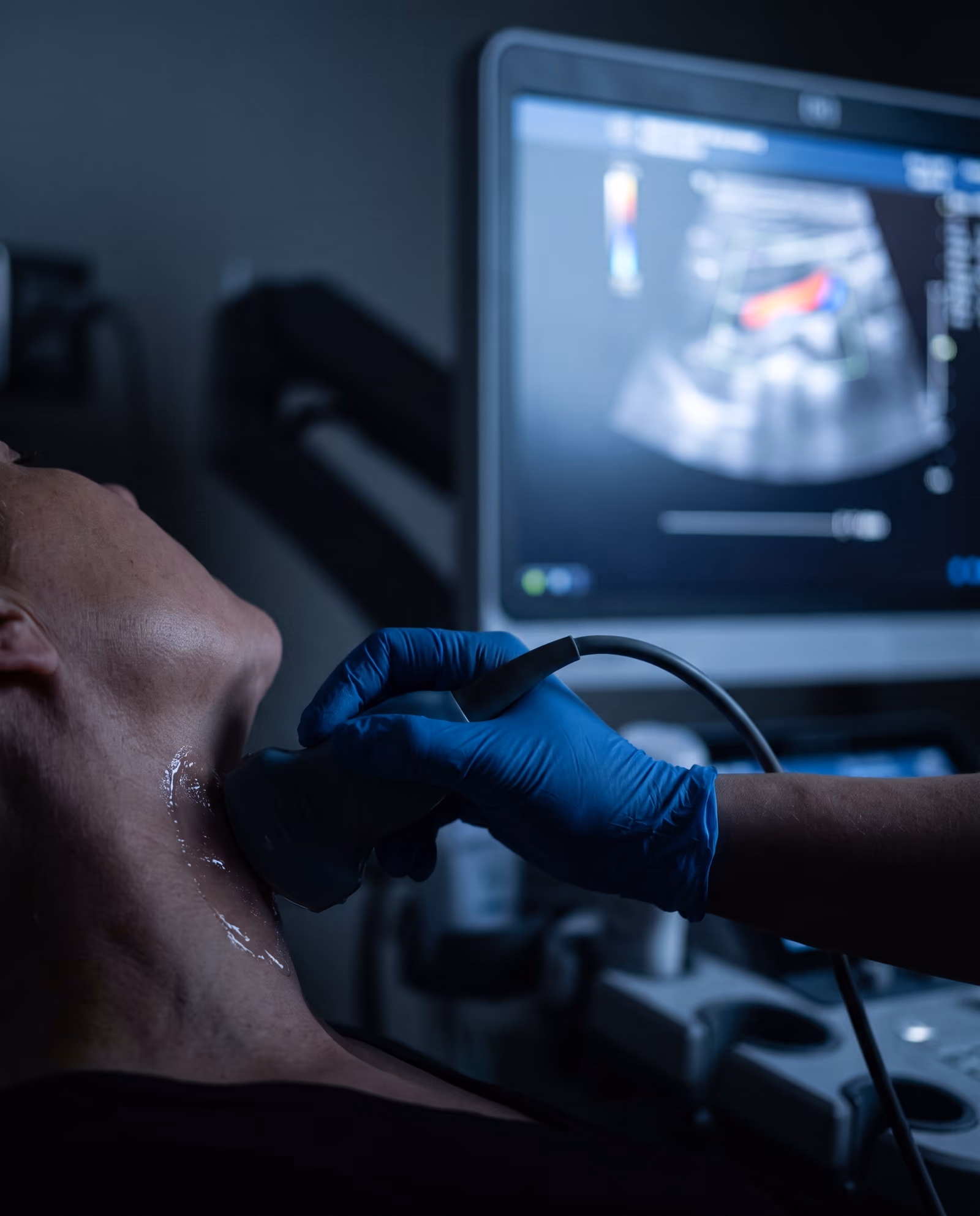 Clinician performing a carotid duplex ultrasound on a patient's neck