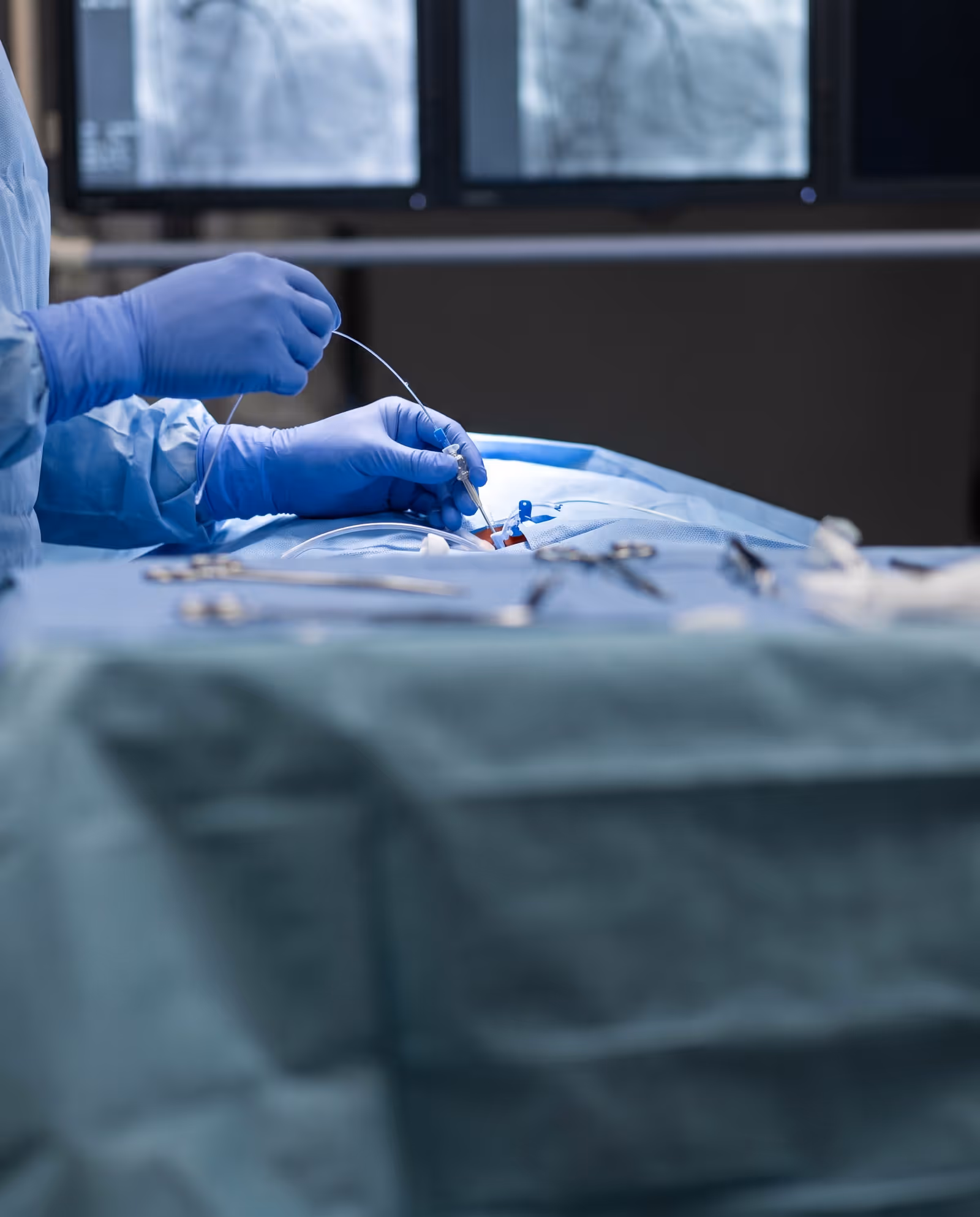 Vascular surgeon in gloves preparing a catheter during a minimally invasive procedure